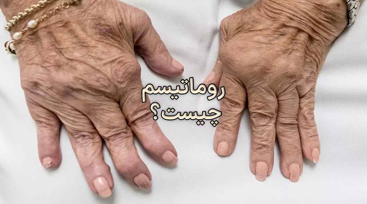 روماتیسم چیست؟