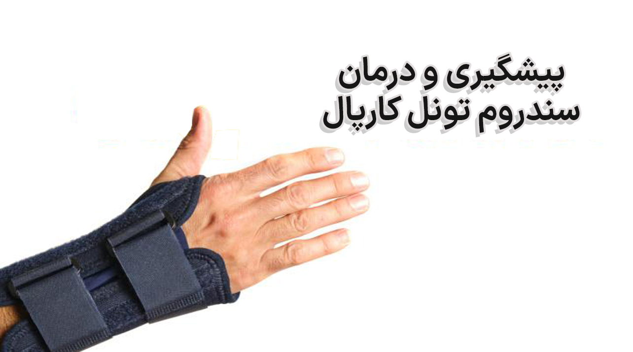 تونل کارپال
