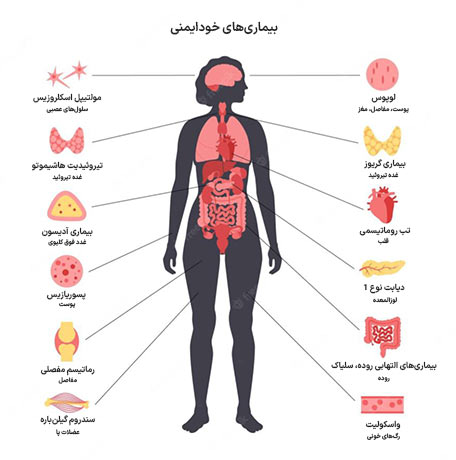بیماری خودایمنی