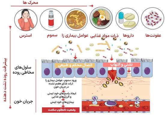 علائم روده نشتدهنده