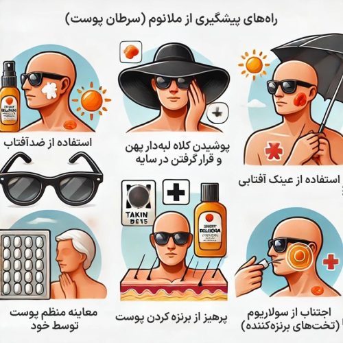 بهترین راه‌های پیشگیری از ملانوم